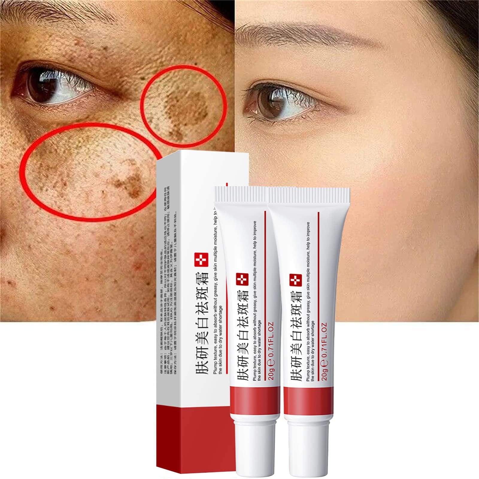 2 Pcs freckle cream for face and dark spot skincare