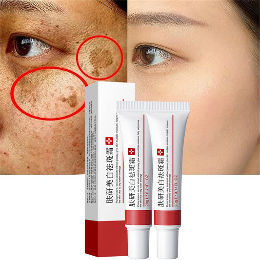 Freckle cream facial treatment for uneven-looking skin