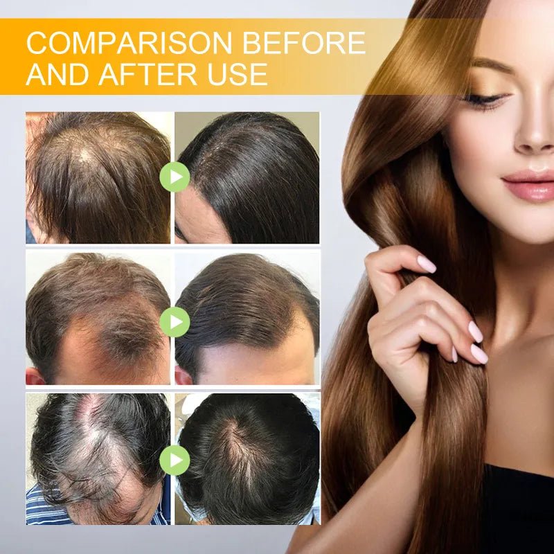 Biotin Hair Growth Spray - Elite Nutrition