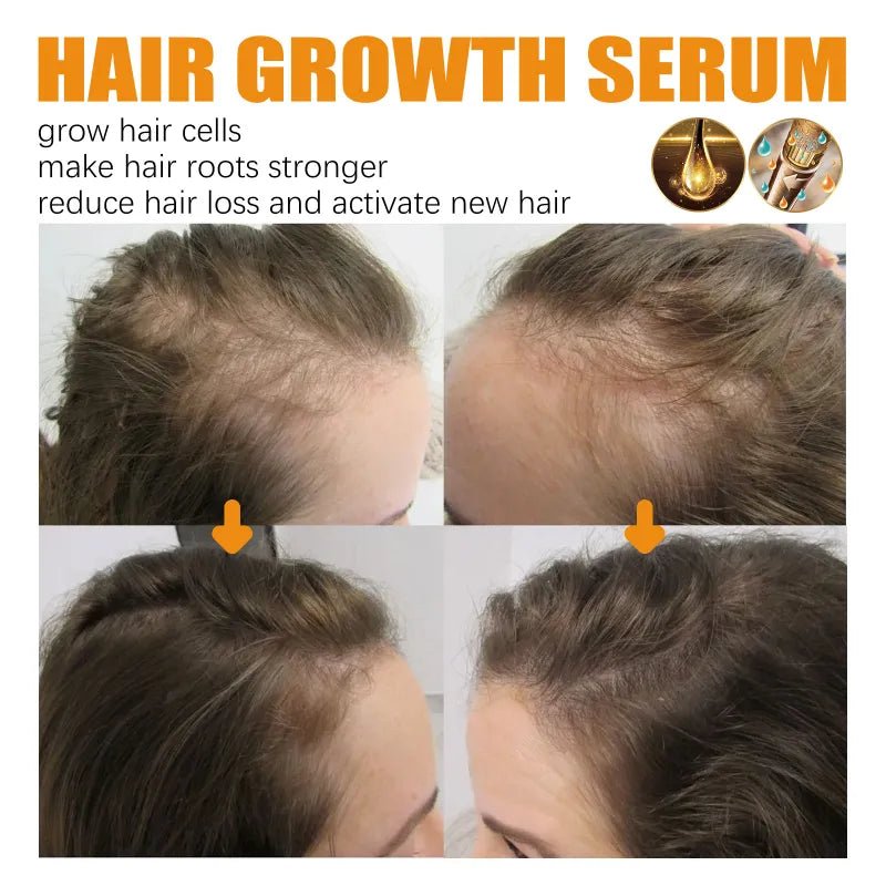 Biotin Hair Growth Spray - Elite Nutrition