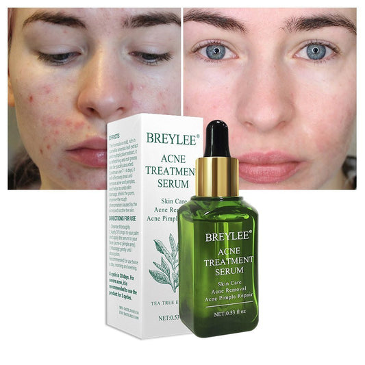 BREYLEE facial acne treatment serum with botanical extracts