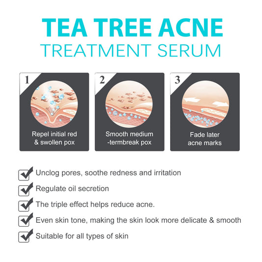 Jaysuing Brightening Acne Cream for Smooth Skin - Elite Nutrition